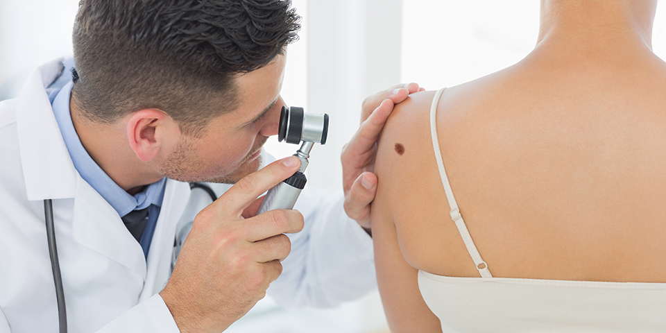 Medico che con una lente di ingrandimento sta controllando il neo di un paziente
